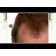 XFusion Keratin Hair Fibers Video